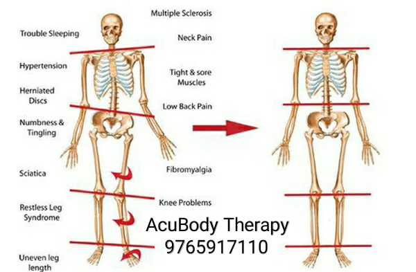 Acupressure Therapists,